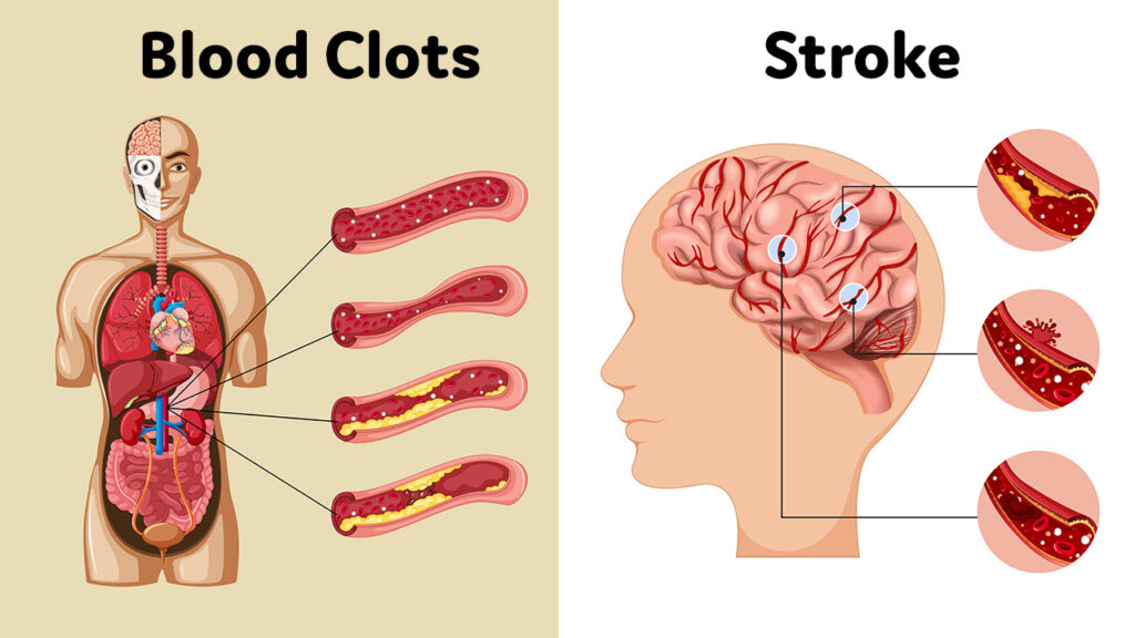 When You Play Video Games Every Day, This Is What Happens To Your Body